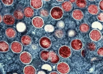 Первый случай обезьяньей оспы зафиксировали за пределами Африки