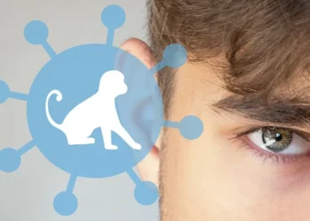 Оспа обезьян: в минздраве РК рассказали о мерах, принятых для предотвращения завоза инфекции в страну