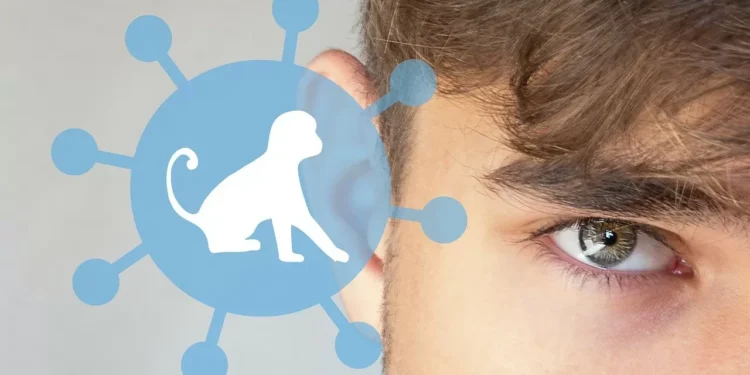 Оспа обезьян: в минздраве РК рассказали о мерах, принятых для предотвращения завоза инфекции в страну